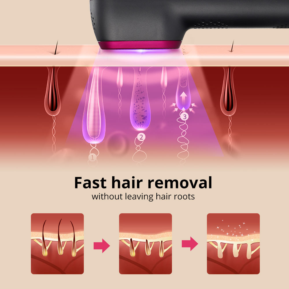 1PCS Laser Hair Removal For Women And Man 100,000 Flashes IPL Painless Laser Hair Removal⭐⭐⭐⭐⭐