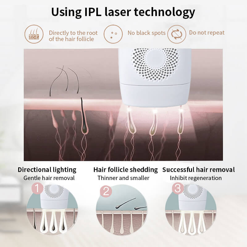 990,000 IPL laser hair removal device⭐⭐⭐⭐⭐